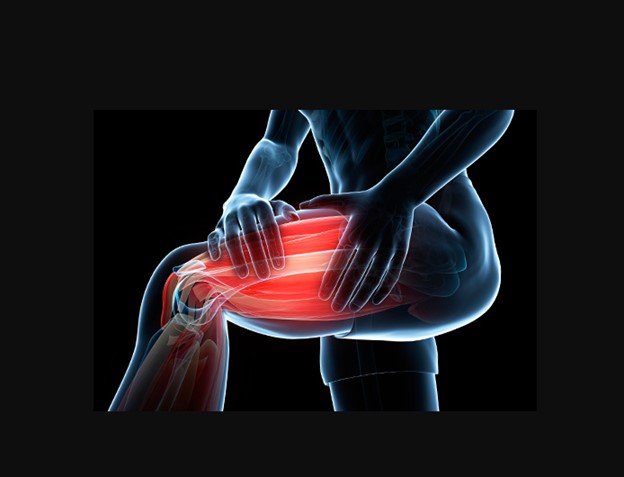 CBD for Muscle Spasms and Other MS Symptoms CBD for Muscle Spasms and Other MS Symptoms